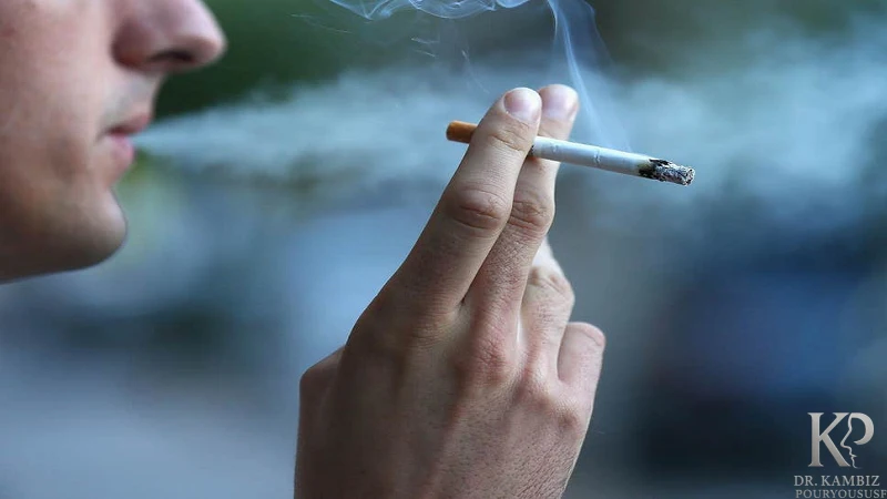 سیگار و قلیان بعد از عمل بینی - دکتر کامبیز پوریوسف
